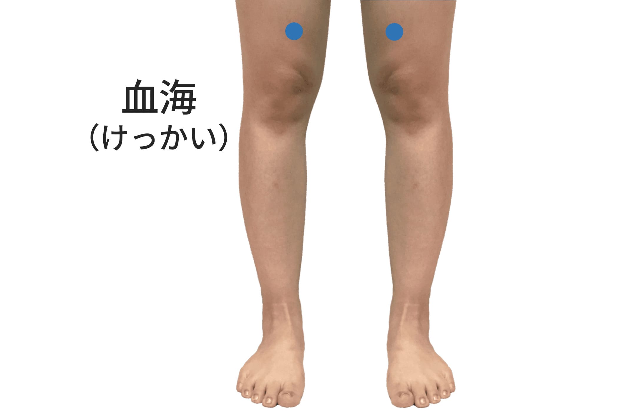 血海のツボの位置